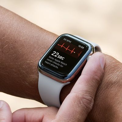 apple watch ecg wrist