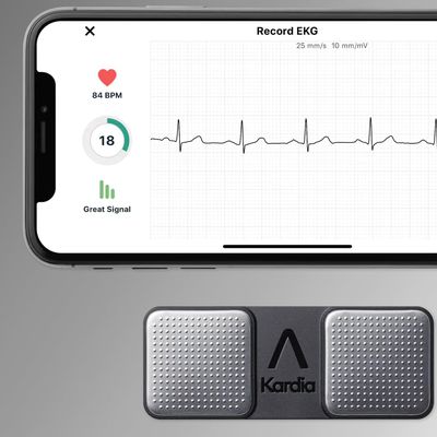 kardiamobile alivecor